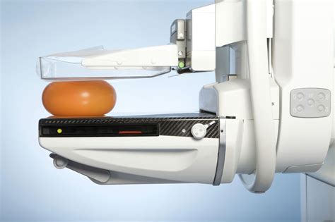 mammography compression test device|mammogram images showing breast cancer.